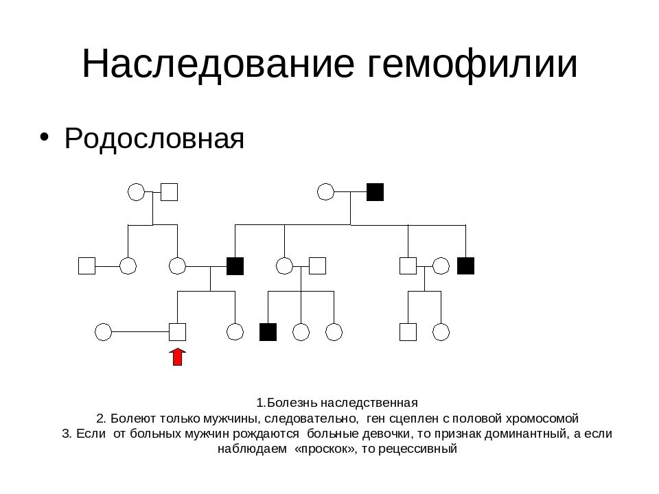 Родословная семьи с наследованием гемофилии. Родословная генетика с гемофилией. Схема наследования гемофилии. Родословная наследования гемофилии.