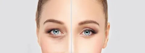 The skin around the eyes
