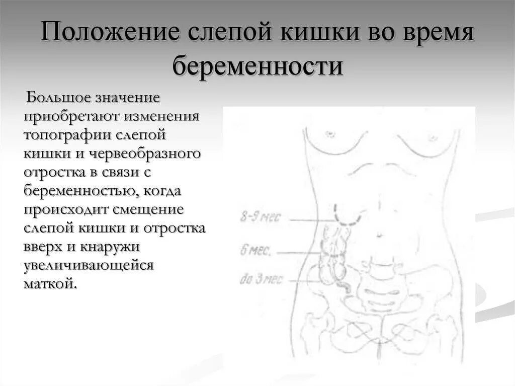 Боли справа у беременной. Болит кишечник у беременной. Расположение кишечника у беременной. Расположение кишечника при беременности.