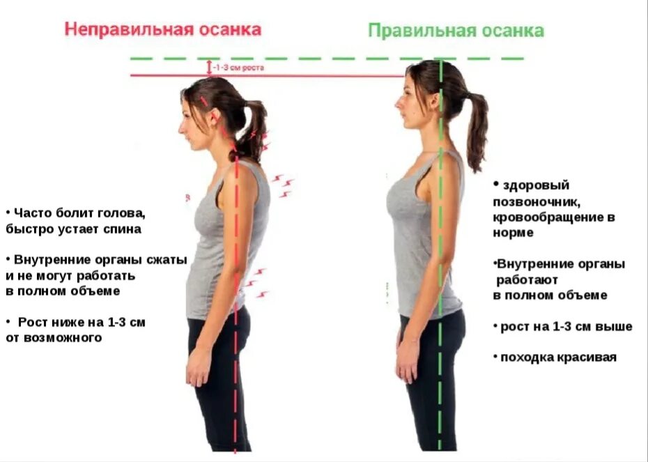 Какая часть тела увеличивается. Правильная осанка. Неправильная осанка. Правильная ОСАНКАОСАНКА. Правильная и неправильная осанка.