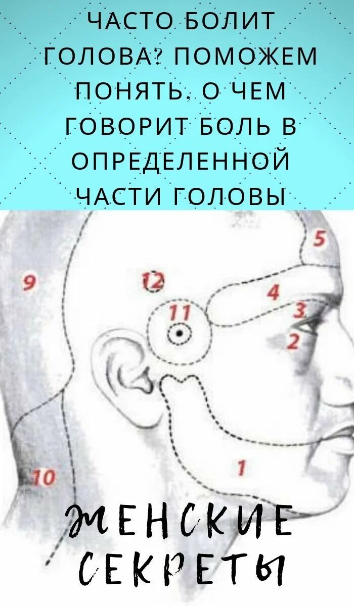 Часто болит голова. Болит затылок. Болит часть головы. Болит в определенной части головы.