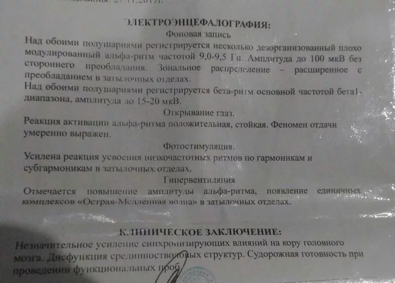 Срок ээг. ЭЭГ норма заключение у взрослого головного. Заключение ЭЭГ видеомониторинг. Варианты заключении ЭЭГ норма.