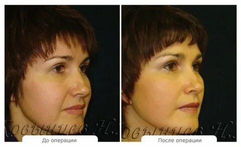 Пластическая хирургия оренбург