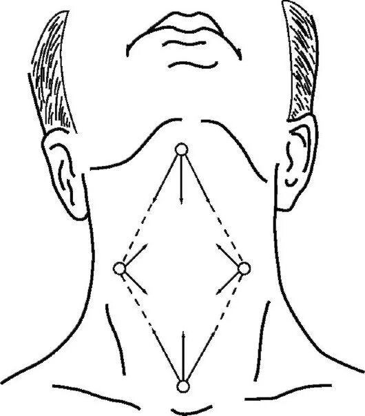 Шея схема. Оперативная хирургия шеи.