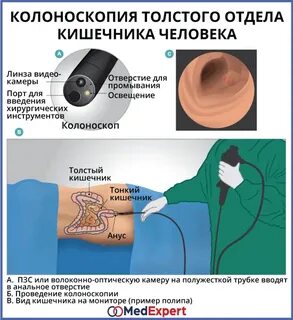 Колоноскопия относится к
