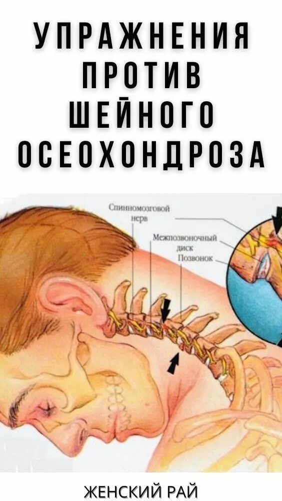 Остеохондроз: виды, симптомы, лечение, профилактика в санатории