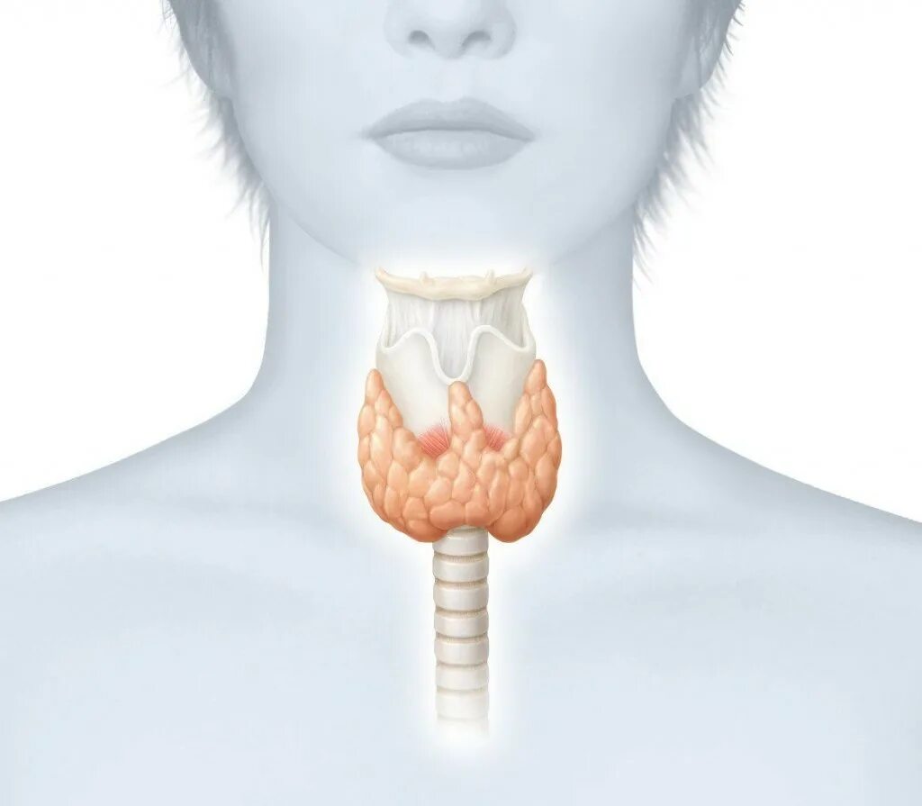 Что такое щитовидная железа. Диффузный эндемический зоб. Эндемический зоб бклассинифкя.