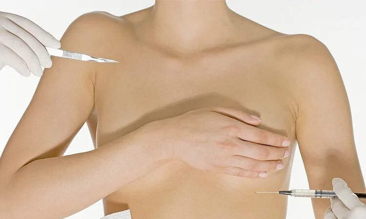 Удаление груди и лимфоузлов. Пластическая хирургия груди. Лифтинг груди.
