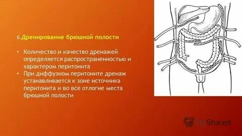 Дренаж при асците