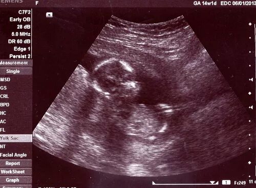 4 мес беременности. живот на 4 месяце. живот на 4 месяце. 4 мес беременности. живот на 5 месяце.