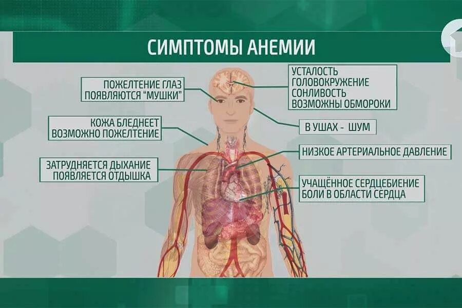 Дефицитные анемии классификация. Анемия у подростков девушек. Анемия у подростков девушек. Анемия у подростков девушек. Не железодефицитная анемия причины.