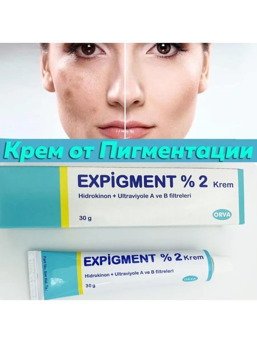 Крем expigment купить. Турецкий отбеливающий крем expigment. Отбеливающий крем expigment 4. Expigment крем 2%. Orva крем отбеливающий expigment.