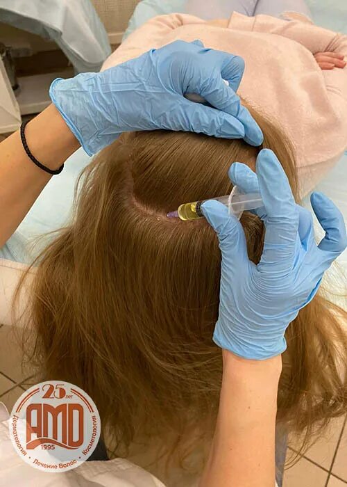 Трихолог вита. Осмотр трихолога. Выпадают волосы амд лаборатории. Выпадают волосы амд лаборатории. Аниме волосы выпадают волосы амд лаборатории.