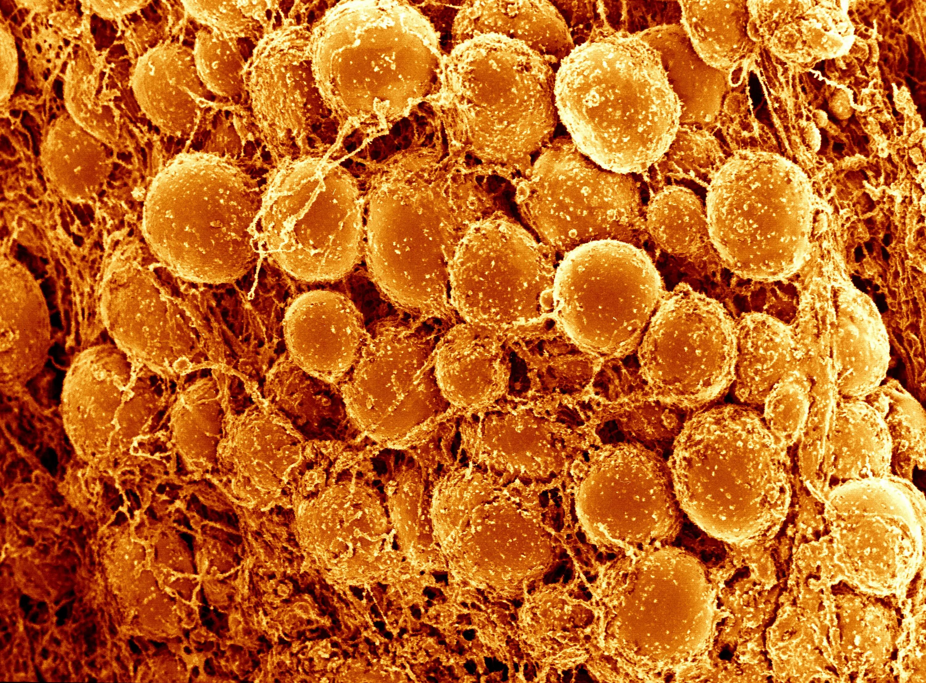 Бурый адипоцит. Жировые клетки адипоциты. Жировая ткань бурая в микроскопе. Бурые жировые клетки.