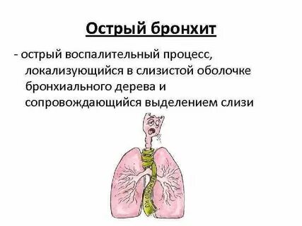 Трахеит у детей лечение без температуры