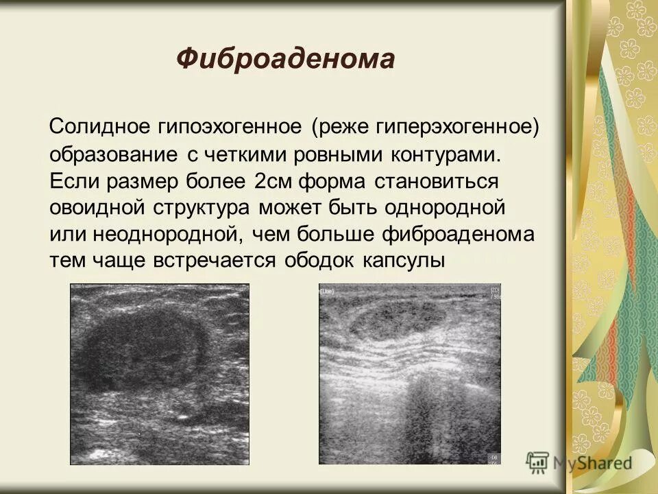 Плотный обнаружить
