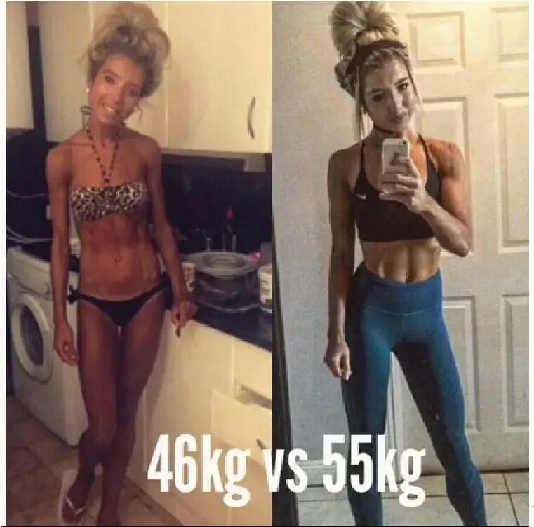 Человек весит 35 кг. Кохно анорексия. Худые девушки до и после.