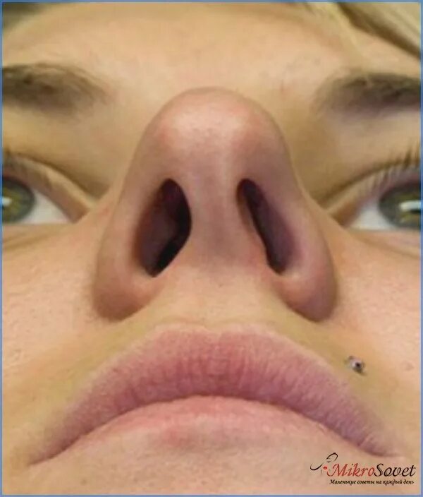 Нос. Покажи как выглядит нос. Септопластика искривление носовой перегородки. Носовая перегородка хрящ строение. Покажи как выглядит нос.