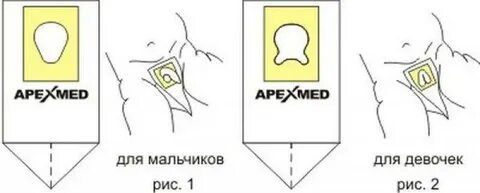 Мочеприемник детский для мальчика как пользоваться