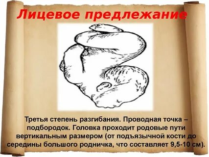 Лицевое предлежание