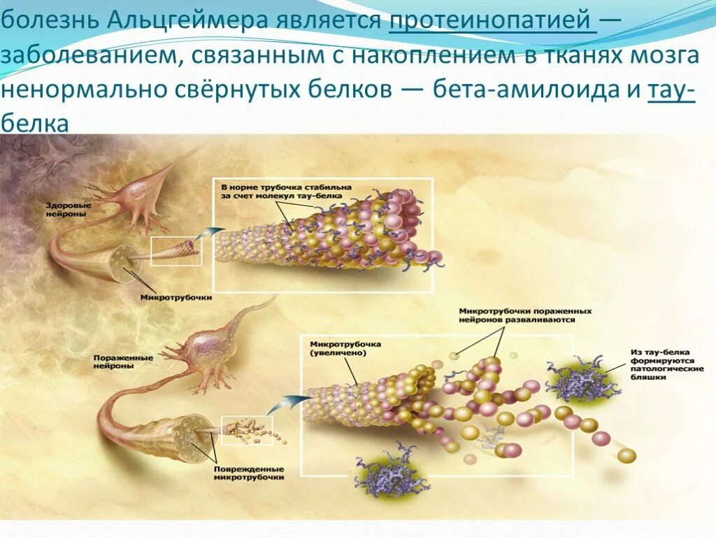 Причины болезни альцгеймера. Патогенез болезни Альцгеймера схема. Болезнь Альцгеймера механизм. Механизм развития Альцгеймера. Предпосылки Альцгеймера.