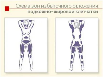 Зона жир