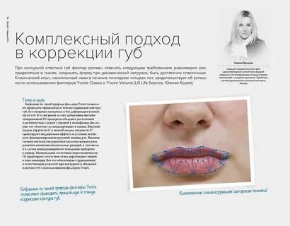 Можно колоть губы во время месячных