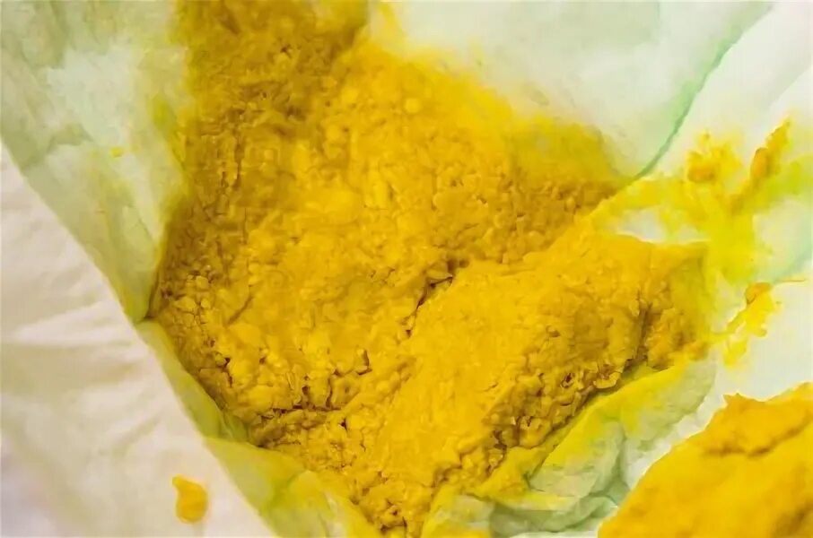 Какашки 2 месячного ребенка. Кал новорожденного при лактазной недостаточности. Меконий у новорожденных. Стул у грудничка 5 месяцев норма. Лактозная недостаточность симптомы у новорожденного.