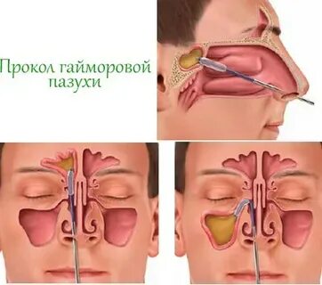 Пазуха снимать