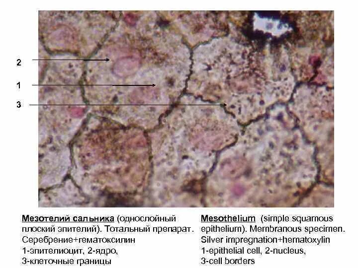 Мезотелий развивается из. Однослойный плоский эпителий мезотелий сальника препарат. Однослойный плоский эпителий мезотелий препарат. Однослойный плоский эпителий мезотелий гистология. Мезотелий гистология препарат.