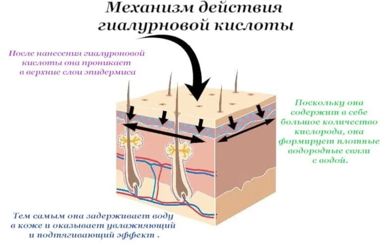 Гиалуроновая кислота где. Механизм действия гиалуроновой кислоты. Гиалуроновая кислота механизм действия. Механизм действия гиалуроновой кислоты на кожу. Высокомолекулярная гиалуроновая кислота для инъекций.