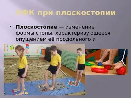 Лфк при плоскостопии