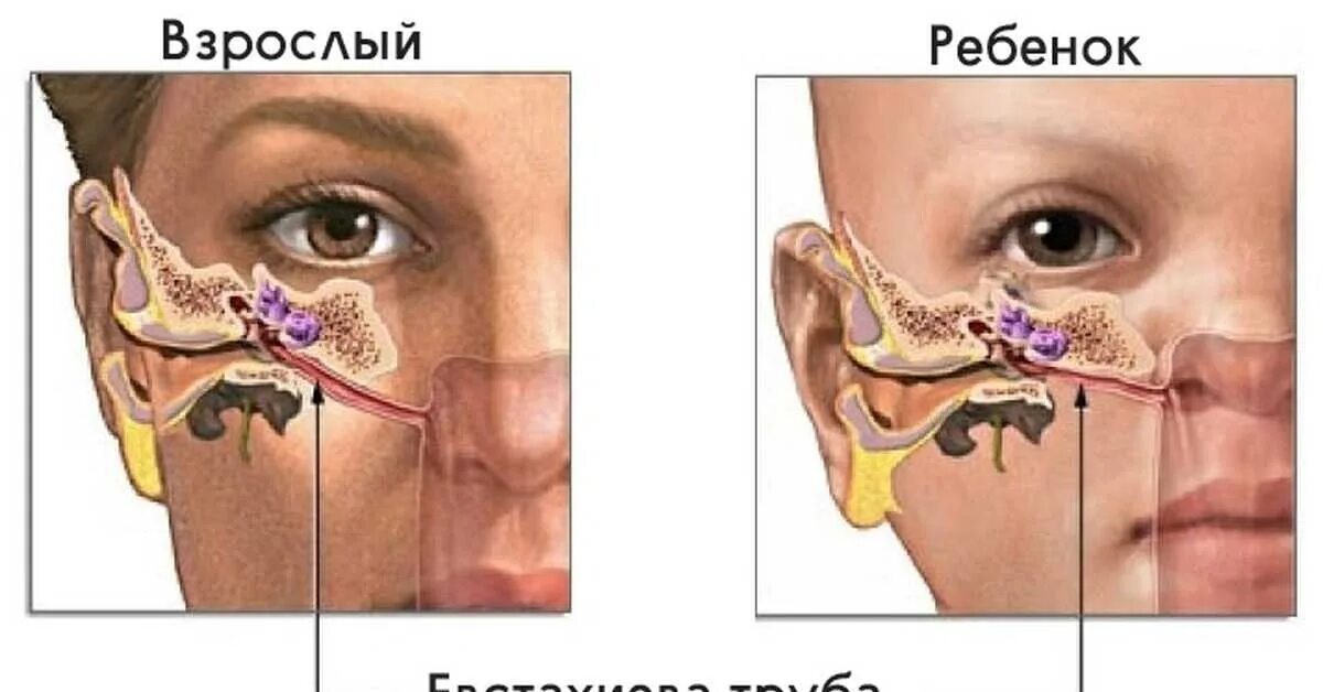 Тубоотит сколько длится заложенность