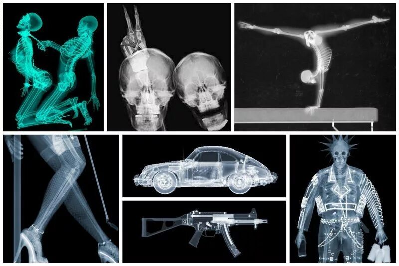 Рентген можно сделать. Рентгеновские снимки Ника визи:. Интересные рентген снимки. Необычный рентгеновский снимок. Необычные предметы на рентгене.