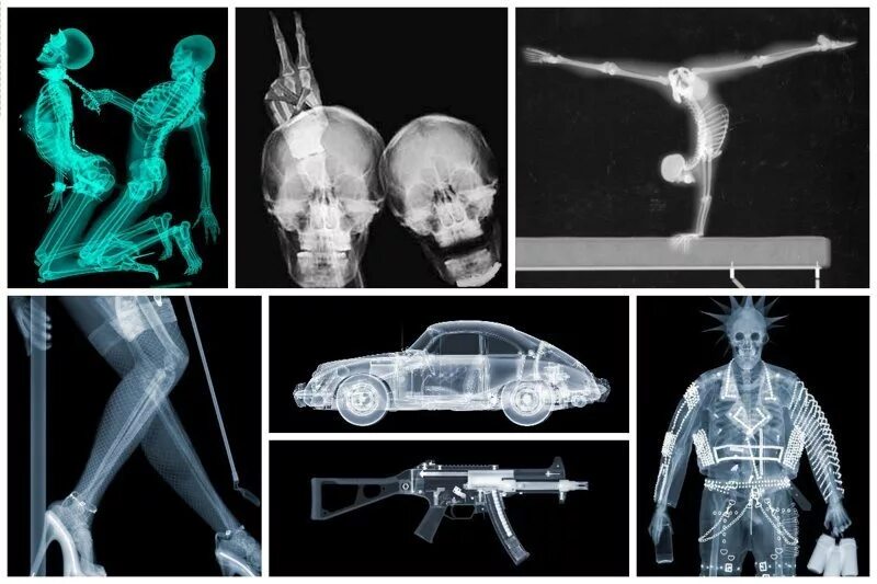 Снимок будут делать. Рентгеновские снимки. Удивительные рентгеновские снимки. Интересные рентген снимки. Необычный рентгеновский снимок.
