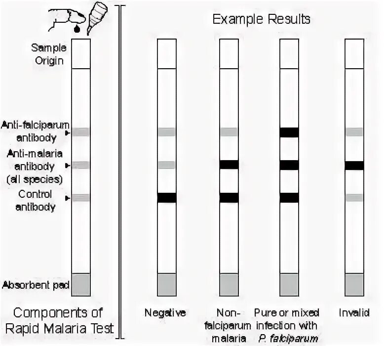 Малярия тестирование. Тест на малярию. Paracheck тест малярия. Протокол на малярию. Malaria outcomes.