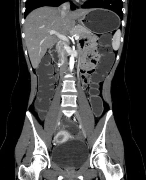Кт брюшной полости что покажет у женщин