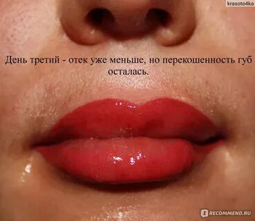Губа держится