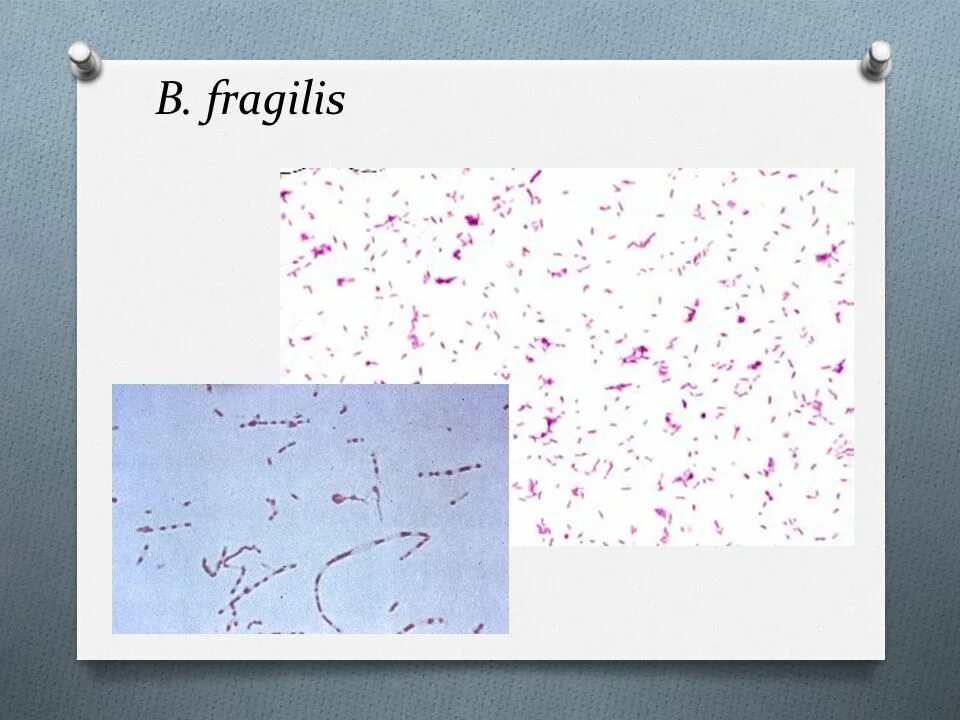 Peptostreptococcus. Бактероиды фрагилис. Фрагилис бактерии. Bacteroides fragilis по Граму. B fragilis микробиология.