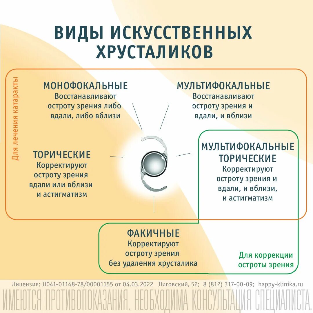 Когда восстанавливается зрение после замены хрусталика. Интраокулярные линзы. Интраокулярные линзы классификация. Монофокальная ИОЛ. Переднекамерные интраокулярные линзы.