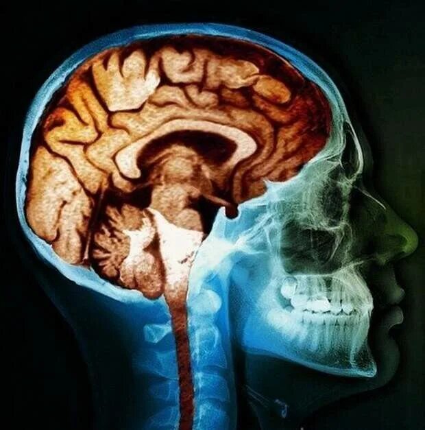 Мозг человека внутри. Мозг человека внутри. Внутренний мозг. Анатомия голов человека. Головной мозг.