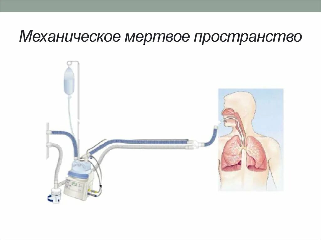 Мертвое пространство. Мёртвое пространство лёгких. Дыхательное Мертвое пространство. Физиологическое мертвое пространство