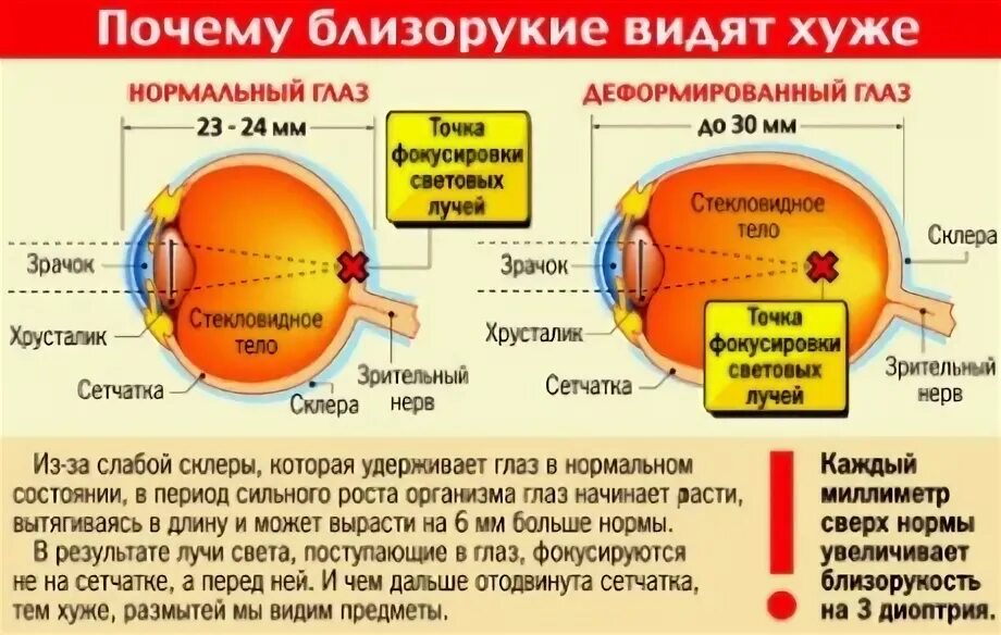 Днем хуже вижу. Глаза плохо видят. Плохо видит левый глаз. Почему человек плохо видит. Почему правый глаз видит хуже.