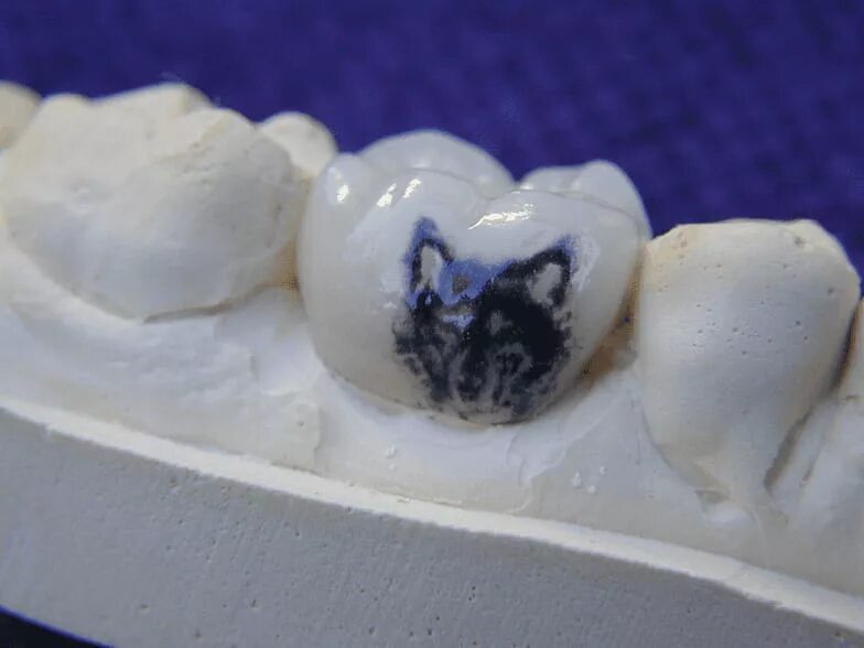 Eight teeth