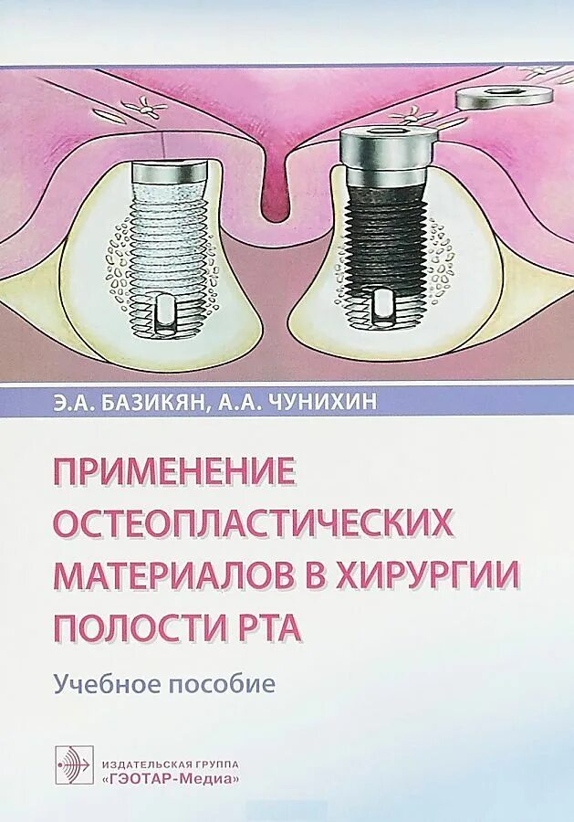 Материал э в а. Остеопластические материалы в хирургической стоматологии. хирургия полости рта базикян. применение остеопластического материала. учебные пособия базикяна.