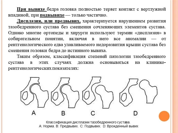 Подвывих тазобедренного сустава у взрослых. Подвывих тазобедренного сустава у взрослых