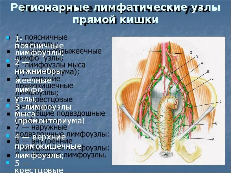 Регионарные лимфоузлы прямой кишки. Регионарные лимфоузлы ободочной кишки. Аортокавальные лимфатические узлы. Верхние прямокишечные лимфатические узлы. Тазовая лимфаденопатия