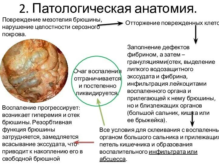 Повреждение нескольких анатомических областей. Повреждение патологическая анатомия. виды повреждений патанатомия. фибрин в брюшной полости. мезотелий брюшины.