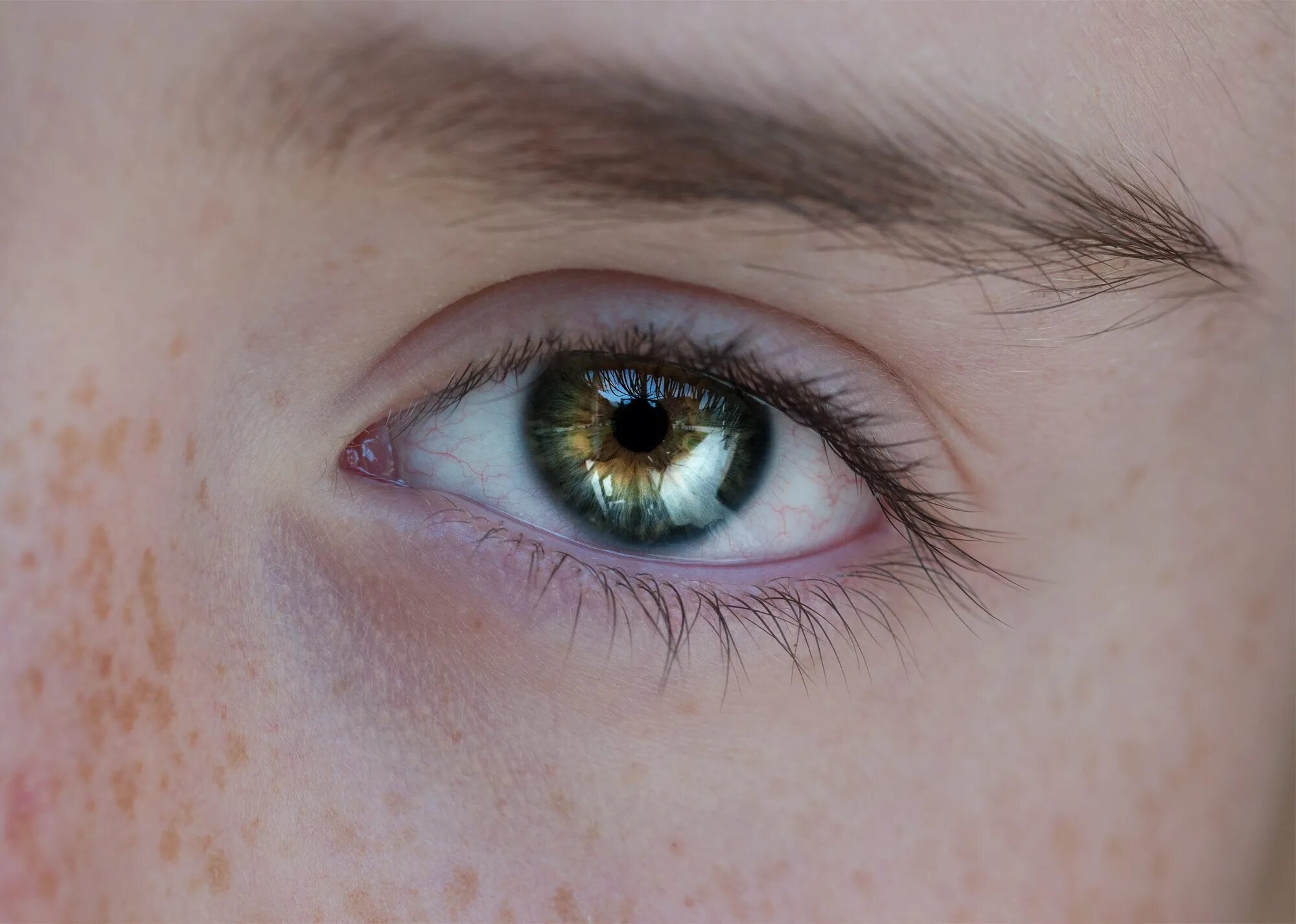 Цвет глаза зависит от пигмента. Гетерохромия Радужки. Центральная гетерохромия карих глаз. Центральная гетерохромия глаз Карий и зеленый. Секторная гетерохромия (частичная).