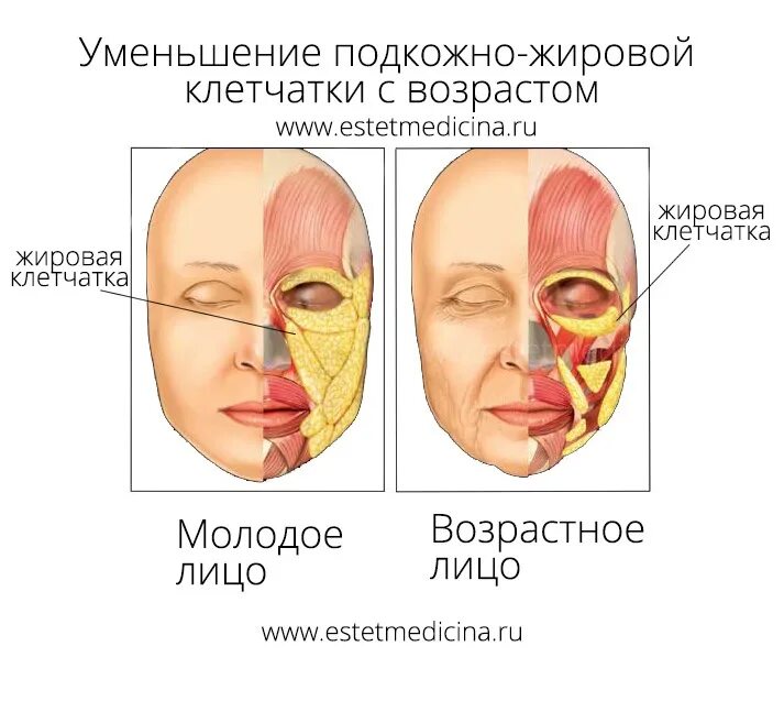 Жировой на лице. Жировые пакеты на лице анатомия. подкожно жировая клетчатка на лице. жировые пакеты лица с возрастом.